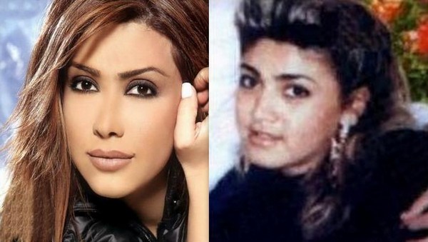 Arab Celebrities Before After